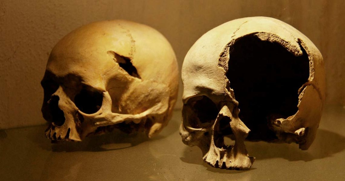 Skeletons Show Horrific Injuries from The Battle of Towton (Video)
